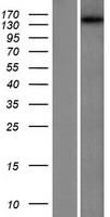 ls023258 dennd5a human over expression lysates nm 015213 wb testing 1