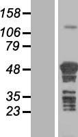 ls023270 tspyl4 human over expression lysates nm 021648 wb testing 1