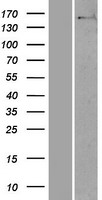 NUP160 Human Over-expression Lysates NM_015231