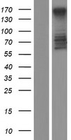 MTUS2 Human Over-expression Lysates NM_001033602