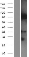 ls023288 iqce human over expression lysates nm 001100390 wb testing 2