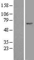 ls023291 beta trcp2 fbxw11 human over expression lysates nm 033644 wb testing 2