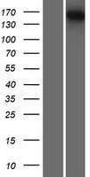 EST1A (SMG6) Human Over-expression Lysates NM_017575