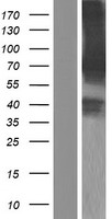 RNF156 (MGRN1) Human Over-expression Lysates NM_001142290