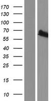 RNF156 (MGRN1) Human Over-expression Lysates NM_001142291