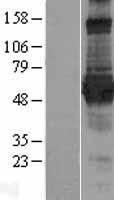 RNF156 (MGRN1) Human Over-expression Lysates NM_015246