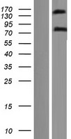 EHBP1 Human Over-expression Lysates NM_015252