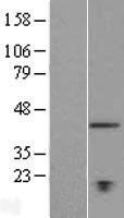 ls023306 tmem194a nemp1 human over expression lysates nm 015257 wb testing 1