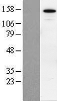 ls023309 sin3b human over expression lysates nm 015260 wb testing 1