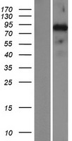 SATB2 Human Over-expression Lysates NM_015265