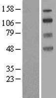 SLC9A8 Human Over-expression Lysates NM_015266