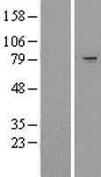 RNF86 (TRIM2) Human Over-expression Lysates NM_015271
