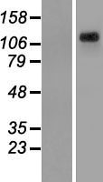 WASH complex subunit 7 (WASHC4) Human Over-expression Lysates NM_015275