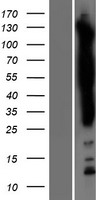 SASH1 Human Over-expression Lysates NM_015278