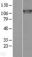 FAM62A (ESYT1) Human Over-expression Lysates NM_015292