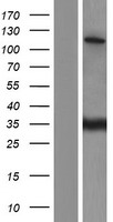 SR140 (U2SURP) Human Over-expression Lysates NM_001080415