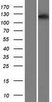 ASPP1 (PPP1R13B) Human Over-expression Lysates NM_015316
