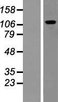 Pumilio 2 (PUM2) Human Over-expression Lysates NM_015317