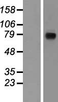 Nicastrin (NCSTN) Human Over-expression Lysates NM_015331
