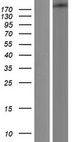 Dicer (DICER1) Human Over-expression Lysates NM_177438