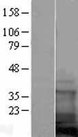 COTL1 Human Over-expression Lysates NM_021149