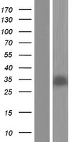 SIRT5 Human Over-expression Lysates NM_031244