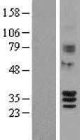 SIRT4 Human Over-expression Lysates NM_012240