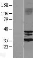 SIRT3 Human Over-expression Lysates NM_012239
