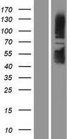 SIRT1 Human Over-expression Lysates NM_012238