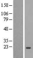 COMMD3 Human Over-expression Lysates NM_012071