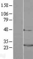 Frequenin (NCS1) Human Over-expression Lysates NM_014286
