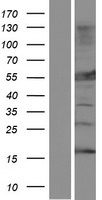 MLYCD Human Over-expression Lysates NM_012213
