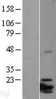 ITGB3BP Human Over-expression Lysates NM_014288