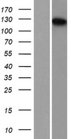 TDRD7 Human Over-expression Lysates NM_014290
