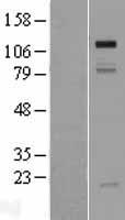GRIP1 Human Over-expression Lysates NM_021150