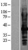 LAT2 (SLC7A8) Human Over-expression Lysates NM_012244