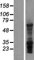 LAT2 (SLC7A8) Human Over-expression Lysates NM_182728