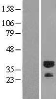 RYBP Human Over-expression Lysates NM_012234
