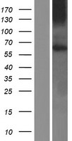 GPR161 Human Over-expression Lysates NM_153832