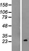 TC10 (RHOQ) Human Over-expression Lysates NM_012249