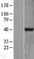 TDP43 (TARDBP) Human Over-expression Lysates NM_007375