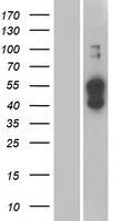 ATP1B4 Human Over-expression Lysates NM_012069