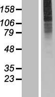 SLC35A3 Human Over-expression Lysates NM_012243