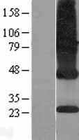 CMT (ICMT) Human Over-expression Lysates NM_012405