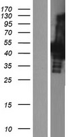 CBX6 Human Over-expression Lysates NM_014292