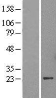 HP1 alpha (CBX5) Human Over-expression Lysates NM_001127322