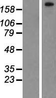 PHF3 Human Over-expression Lysates NM_015153