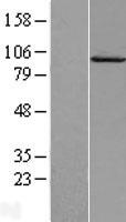 Calpain 7 (CAPN7) Human Over-expression Lysates NM_014296