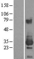 ls023474 ethe1 human over expression lysates nm 014297 wb testing 1