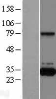 QPRT Human Over-expression Lysates NM_014298